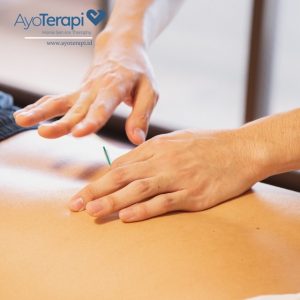 AKUPUNTUR DI JAKARTA 087709999200