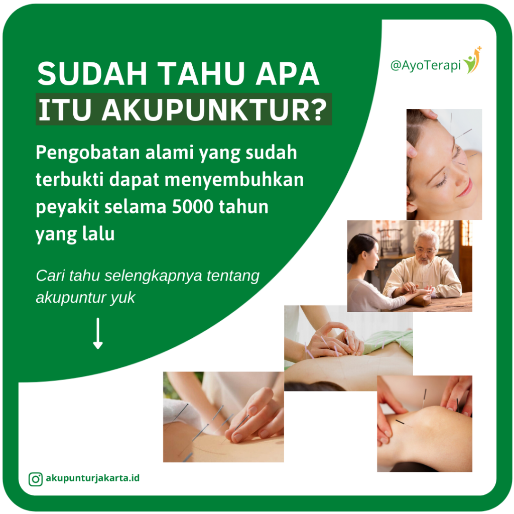 HOME SERVICE AKUPUNTUR BERPENGALAMAN